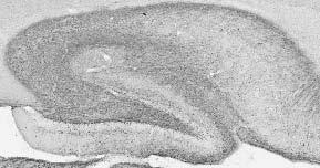 Adult rat hippocampus immunohistochemistry.