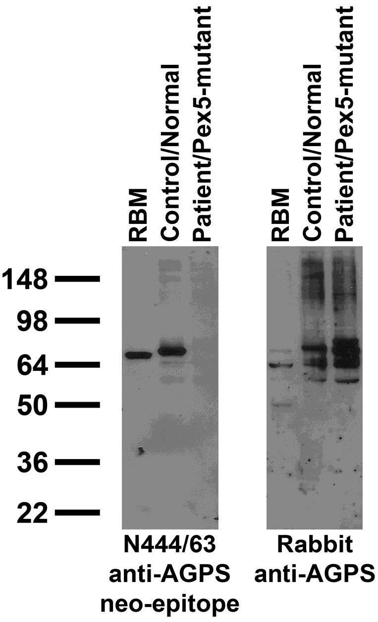 Adult rat brain membrane (RBM) and human cell immunoblot: lysates of RBM and fibroblasts from unaffected (control/normal) and disease-affected (patient/Pex5-mutant) humans probed with N444/63 TC supe (left) and rabbit polyclonal (right).  Human fibroblast samples courtesy of Ning Huang and Joseph Hacia (USC) and rabbit polyclonal courtesy of Nancy Braverman (McGill).