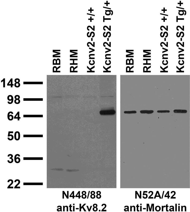 Immunoblot against membrane fractions from adult rat brain (RBM) and heart (RHM) and Kcnv2-S2 mouse wild-type (+/+) and higher-expressing transgenic (Tg/+) brains probed with N448/88 (left) and N52A/42 (right) TC supe. Mouse brain samples courtesy of Jennifer Kearney (Northwestern).