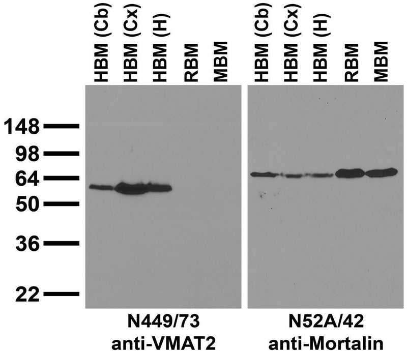 Immunoblot on crude membrane fractions from whole mouse (MBM) and rat (RBM) brain and from human hippocampus [HBM(H)], cerebral cortex [HBM(Cx)] and cerebellum [HBM(Cb)] probed with N449/73 (left) and N52A/42 (right) TC supe.