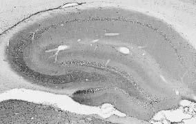 Adult rat hippocampus immunohistochemistry.