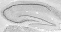 Adult rat hippocampus immunohistochemistry.
