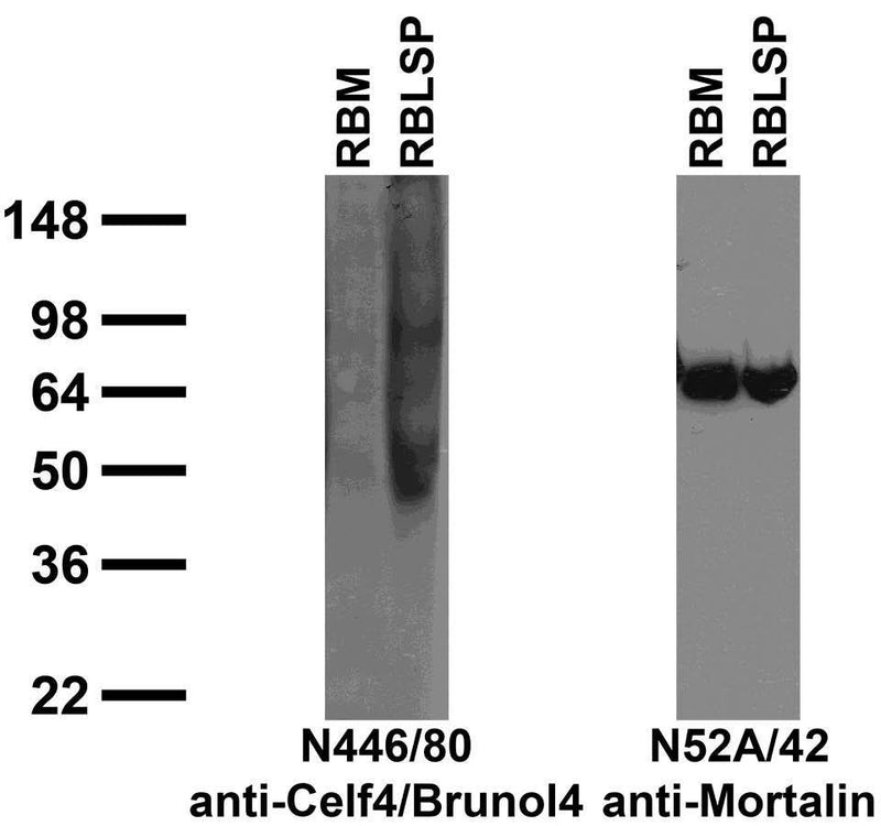 Adult rat brain membrane (RBM) and low-speed pellet (RBLSP) immunoblot.