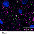 Array tomography immunofluorescence of an LRWhite-embedded 70 nm section from adult mouse cortex with L106/83 (green), rabbit mAb GAD2 (Cell Signaling 5843, magenta) and DAPI (blue). The insert shows three consecutive sections through the synapse that is marked with a white box. Image courtesy of Kristina Micheva (Stanford).