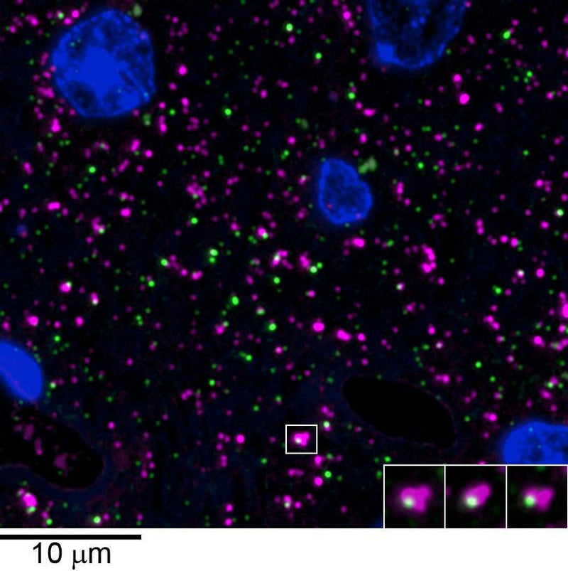 Array tomography immunofluorescence of an LRWhite-embedded 70 nm section from adult mouse cortex with L106/83 (green), rabbit mAb GAD2 (Cell Signaling