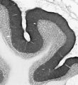 Adult rat cerebellum immunohistochemistry.