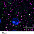 Array tomography immunofluorescence of an LRWhite-embedded 70 nm section from adult mouse cortex with L106/93 (green), rabbit mAb GAD2 (Cell Signaling 5843, magenta) and DAPI (blue). The insert shows three consecutive sections through the synapse that is marked with a white box. Image courtesy of Kristina Micheva (Stanford).
