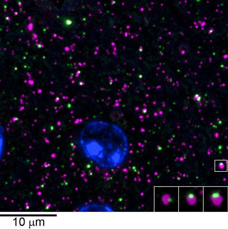 Array tomography immunofluorescence of an LRWhite-embedded 70 nm section from adult mouse cortex with L106/93 (green), rabbit mAb GAD2 (Cell Signaling