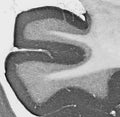 Adult rat hippocampus immunohistochemistry.