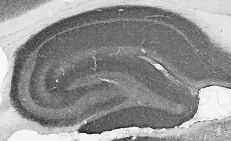 Cerebellum immunohistochemistry.