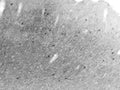 Adult rat visual cortex (note interneurons) immunohistochemistry.