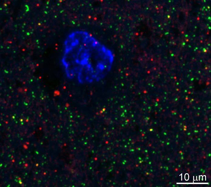 Array tomography immunofluorescence of an LRWhite-embedded 70 nm section from adult mouse cortex layer 5 with L117/1 (red), rabbit mAb PSD-95 (Cell Signaling