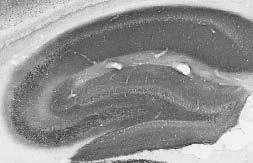 Adult rat hippocampus immunohistochemistry.