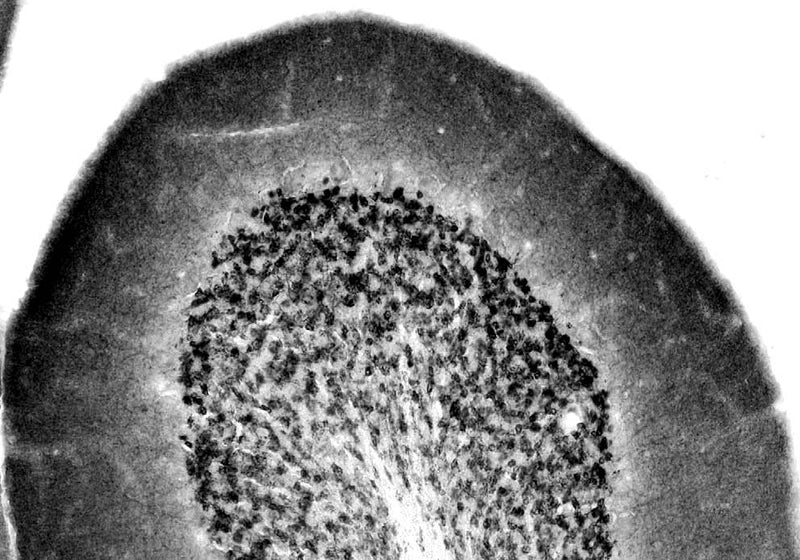 Adult rat cerebellum immunohistochemistry.