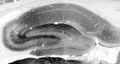 Adult rat hippocampus immunohistochemistry.