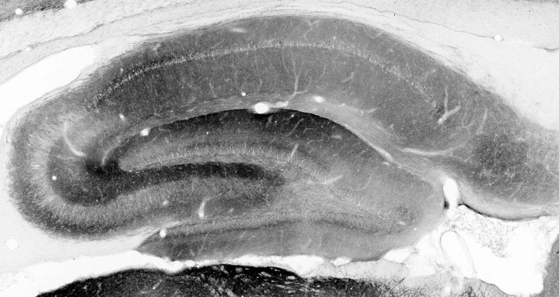 Adult rat hippocampus immunohistochemistry.