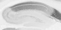 Adult rat hippocampus immunohistochemistry.