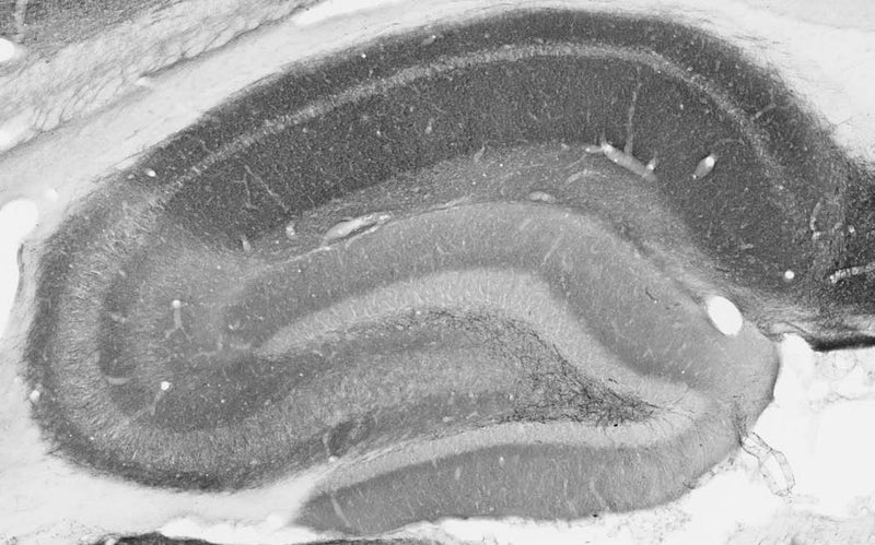 Adult rat hippocampus immunohistochemistry.