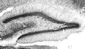 Adult rat hippocampus immunohistochemistry.