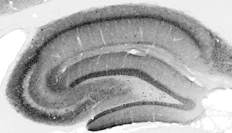 Adult rat hippocampus immunohistochemistry.