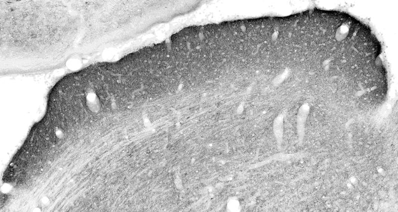 Adult rat superior colliculus immunohistochemistry.