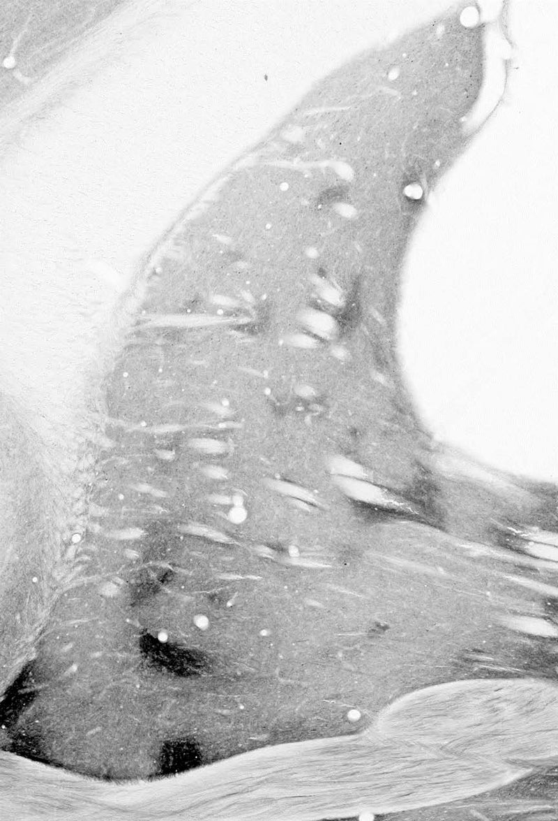 adult rat striatum immunohistochemistry