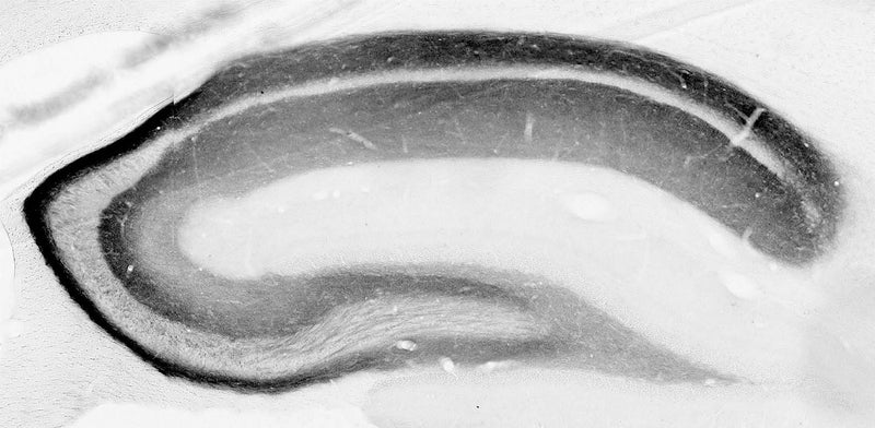adult rat hippocampus immunohistochemistry