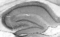 Adult rat hippocampus immunohistochemistry.