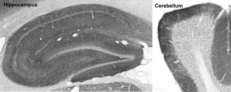 Adult rat hippocampus (left) and cerebellum (right) immunohistochemistry.