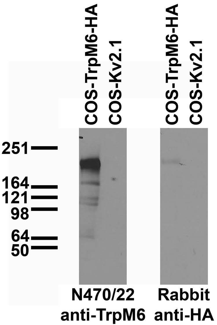 Immunoblot against extracts of COS cells transiently transfected with HA-tagged TrpM6 or untagged Kv2.1 plasmid probed with N470/22 (left) or rabbit anti-HA (right)..