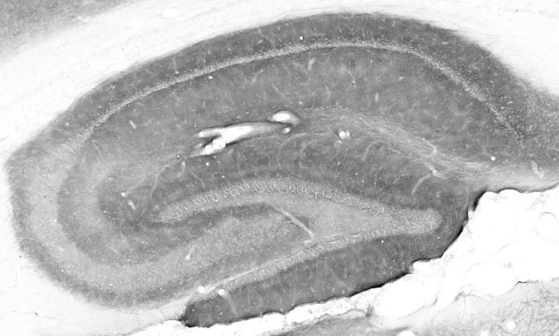 Adult rat hippocampus immunohistochemistry.