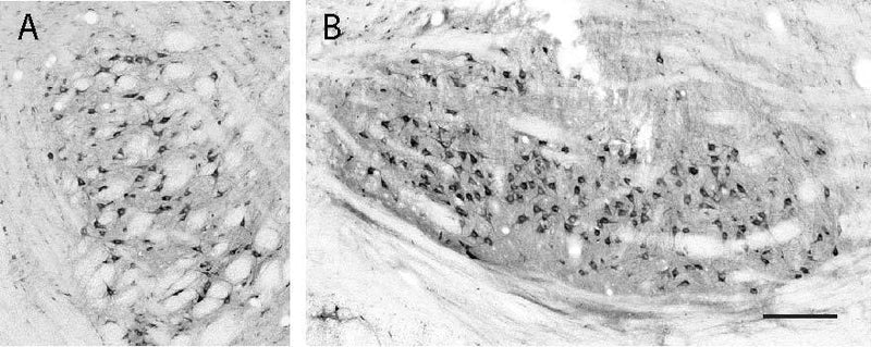 Adult rat brainstem immunohistochemistry of motor trigeminal nucleus (A) and facial motor nucleus (B). Scale bar = 500 µm.