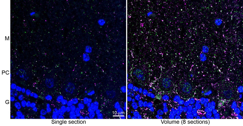Array tomography immunofluorescence of a single 70 nm section (left) and volume reconstruction of 8 serial sections (right) of LRWhite-embedded adult mouse cerebellum with L118/66 (VGAT, green), rabbit mAb GAD2 (Cell Signaling