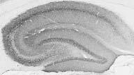 Adult rat brain hippocampus immunohistochemistry.