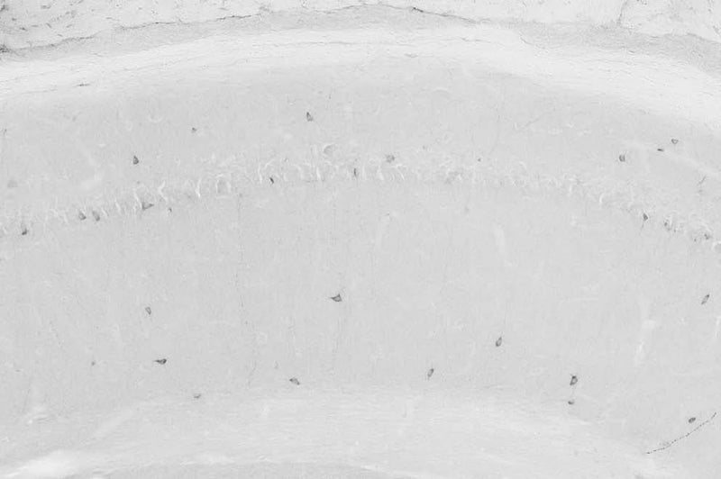 Adult rat hippocampus immunohistochemistry.