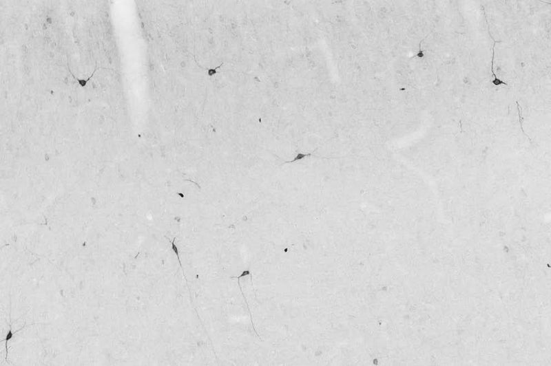 Adult rat cortex immunohistochemistry.