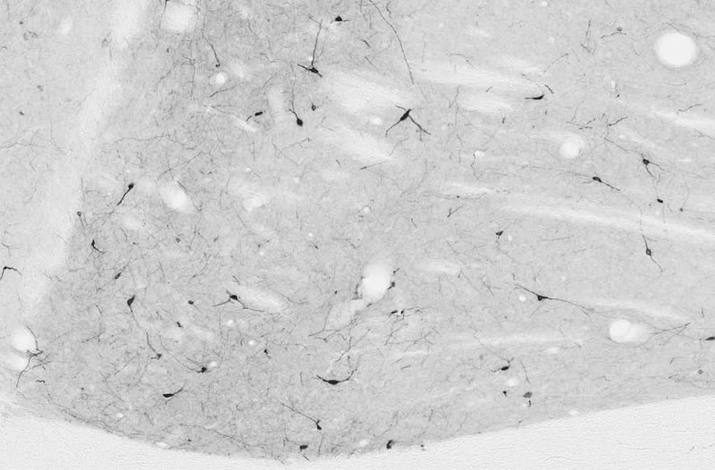 Adult rat striatum immunohistochemistry.