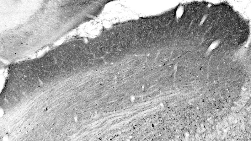 Adult rat superior colliculus immunohistochemistry.