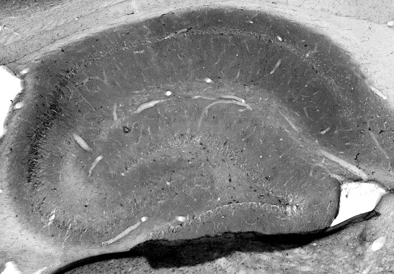 Adult rat hippocampus immunohistochemistry.