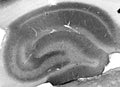 Adult rat hippocampus immunohistochemistry.