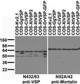 Immunoblot against extracts of COS cells transiently transfected with GFP-tagged zebrafish VSP (DrVSP) or untagged Xenopus (XtVSP, XlVSP and XlVSP2), sea squirt (CiVSP), chicken VSP (GgVSP) or Kv2.1 plasmid probed with N432/63 (left) or N52A/42 (right) TC supe.