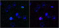 Array tomography immunofluorescence of a single 70 nm LRWhite-embedded section from adult mouse cortex with L122/6 (green, left), rabbit Calretinin (red, right) and DAPI (blue). Images courtesy of Kristina Micheva (Stanford).