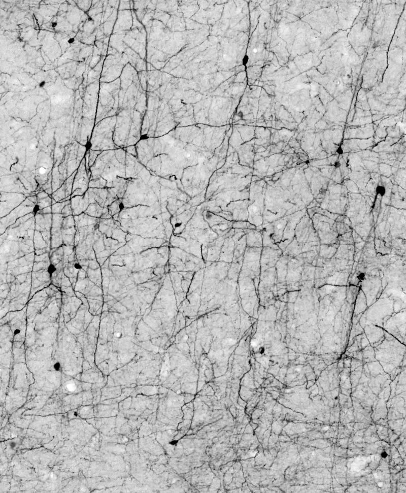 Adult rat cortex immunohistochemistry.