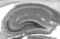 Adult rat hippocampus immunohistochemistry.