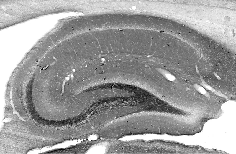 Adult rat hippocampus immunohistochemistry.
