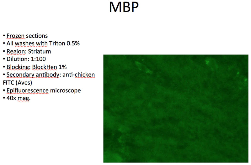 MBP: frozen sections; all washes with Triton 0.5%; Region: Striatum; Blocking: BlockHen 1%; Secondary antibody: anti-chicken FITC (Aves); Epifluorescence microscope; 40x magnification.